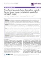 Transforming growth factor-ß signalling controls human breast cancer metastasis in a zebrafish xenograft model