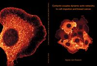 Cortactin couples dynamic actin networks to cell migration and breast cancer