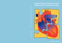 Optimal timing of pulmonary valve replacement in tetralogy of Fallot