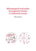 Microscopical evaluation of prognostic factors in colorectal cancer