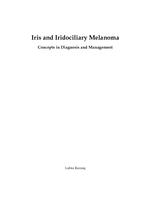 Iris and iridociliary melanoma : concepts in diagnosis and management