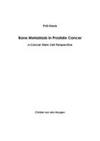 Bone metastasis in prostate cancer : a cancer stem cell perspective