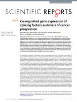 Co-regulated gene expression of splicing factors as drivers of cancer progression