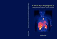 Hereditary paragangliomas : clinical characteristics and genotype-phenotype associations