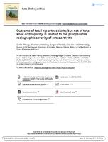 Outcome of total hip arthroplasty, but not of total knee arthroplasty, is related to the preoperative radiographic severity of osteoarthritis A prospective cohort study of 573 patients