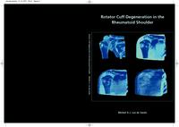 Rotator cuff degeneration in the rheumatoid shoulder : 'the issue is soft tissue'