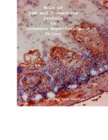 Role of IgM and C-reactive protein in ischemia reperfusion injury