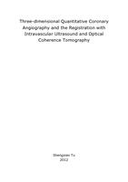 Three-dimensional quantitative coronary angiography and the registration with intravascular ultrasound and optical coherence tomography