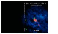5-ASA - colorectal cancer - cell death : an intriguing threesome