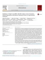 Inhibition of 14q32 microRNA miR-495 reduces lesion formation, intimal hyperplasia and plasma cholesterol levels in experimental restenosis