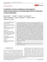 Localization of Active Endogenous and Exogenous GBA by Correlative Light-Electron Microscopy in Human Fibroblasts