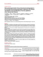 Stereophotogrammetric three-dimensional photography is an accurate and precise planimetric method for the clinical visualization and quantification of human papilloma virus-induced skin lesions