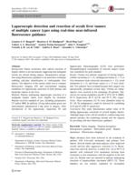 Laparoscopic detection and resection of occult liver tumors of multiple cancer types using real-time near-infrared fluorescence guidance