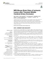 MRI Mouse Brain Data of Ischemic Lesion after Transient Middle Cerebral Artery Occlusion