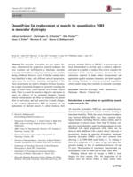 Quantifying fat replacement of muscle by quantitative MRI in muscular dystrophy