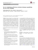 In vivo visualization of the locus coeruleus in humans: quantifying the test-retest reliability