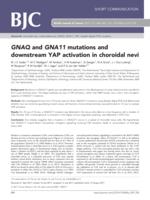 GNAQ and GNA11 mutations and downstream YAP activation in choroidal nevi