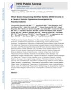 Whole-Exome Sequencing Identifies Biallelic IDH3A Variants as a Cause of Retinitis Pigmentosa Accompanied by Pseudocoloboma