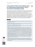 Transcatheter Mitral Valve Replacement for Degenerated Bioprosthetic Valves and Failed Annuloplasty Rings