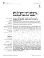 ALK1Fc Suppresses the Human Prostate Cancer Growth in in Vitro and in Vivo Preclinical Models