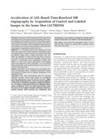 Acceleration of ASL-based time-resolved MR angiography by acquisition of control and labeled images in the same shot (ACTRESS)