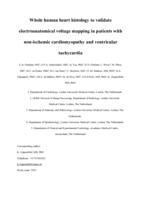 Whole human heart histology to validate electroanatomical voltage mapping in patients with non-ischaemic cardiomyopathy and ventricular tachycardia