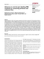 Advances in arterial spin labelling MRI methods for measuring perfusion and collateral flow