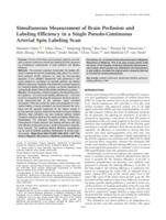 Simultaneous measurement of brain perfusion and labeling efficiency in a single pseudo-continuous arterial spin labeling scan