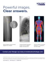 Thyroid Stimulating Hormone and Bone Mineral Density: Evidence From a Two-Sample Mendelian Randomization Study and a Candidate Gene Association Study