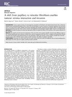 A shift from papillary to reticular fibroblasts enables tumour-stroma interaction and invasion