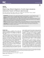 Improving clinical diagnosis of early-stage cutaneous melanoma based on Raman spectroscopy