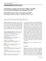 Chemotherapy-resistant osteosarcoma is highly susceptible to IL-15-activated allogeneic and autologous NK cells