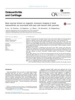 Bone marrow lesions on magnetic resonance imaging in hand osteoarthritis are associated with pain and interact with synovitis