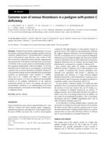 Genome scan of venous thrombosis in a pedigree with protein C deficiency