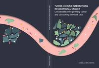 Tumor-immune interactions in colorectal cancer: link between the primary tumor and circulating immune cells