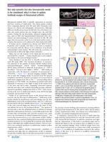 Not only synovitis but also tenosynovitis needs to be considered: why it is time to update textbook images of rheumatoid arthritis