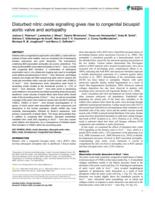 Disturbed nitric oxide signalling gives rise to congenital bicuspid aortic valve and aortopathy