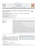 Myelin water imaging from multi-echo T-2 MR relaxometry data using a joint sparsity constraint