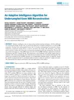 An adaptive intelligence algorithm for under sampled knee MRI reconstruction