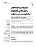 The evolution of data fusion methodologies developed to reconstruct coronary artery geometry from intravascular imaging and coronary angiography data: a comprehensive review