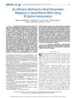 An efficient method for multi-parameter mapping in quantitative MRI using B-spline interpolation