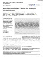 Intracerebral hemorrhage in a neonate with an intragenic COL4A2 duplication