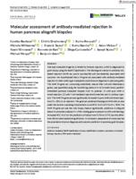 Molecular assessment of antibody-mediated rejection in human pancreas allograft biopsies