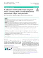 A radiostereometric and clinical long-term follow-up study of the surface replacement trapeziometacarpal joint prosthesis