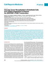 Vascular tumor recapitulated in endothelial cells from hiPSCs engineered to express the SERPINE1-FOSB translocation