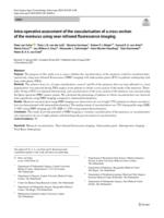 Intra-operative assessment of the vascularisation of a cross section of the meniscus using near-infrared fluorescence imaging