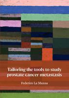 Tailoring the tools to study prostate cancer metastasis