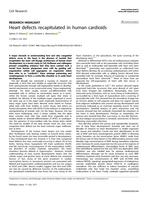 Heart defects recapitulated in human cardioids