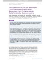 Electroanatomical voltage mapping to distinguish right-sided cardiac sarcoidosis from arrhythmogenic right ventricular cardiomyopathy