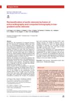 Reclassification of aortic stenosis by fusion of echocardiography and computed tomography in low-gradient aortic stenosis